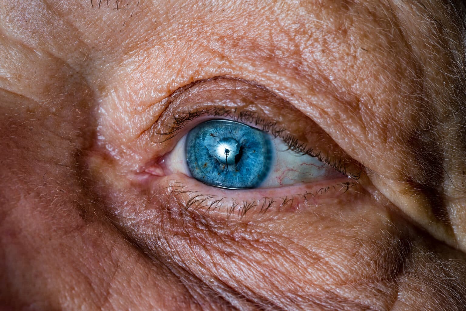 home-care-assistance-how-seniors-can-avoid-dry-eyes-in-summer-a